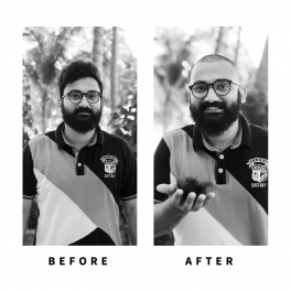 Baldihappy-BeforeAfter-Donors-01