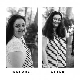 Baldihappy-BeforeAfter-Donors-02