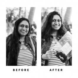 Baldihappy-BeforeAfter-Donors-03