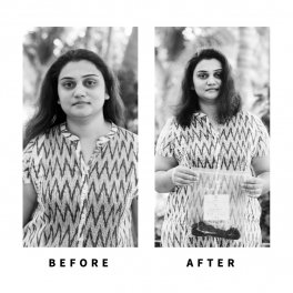 Baldihappy-BeforeAfter-Donors-05