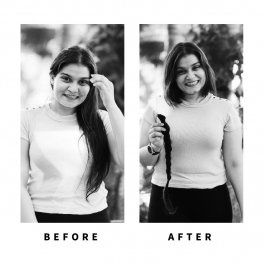 Baldihappy-BeforeAfter-Donors-06