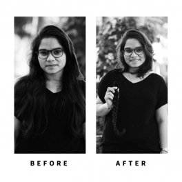 Baldihappy-BeforeAfter-Donors-07