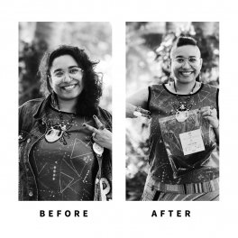 Baldihappy-BeforeAfter-Donors-08