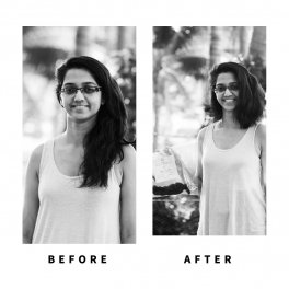 Baldihappy-BeforeAfter-Donors-09