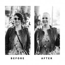 Baldihappy-BeforeAfter-Donors-10