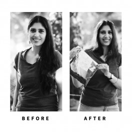 Baldihappy-BeforeAfter-Donors-11