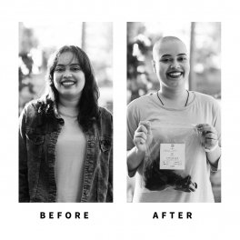 Baldihappy-BeforeAfter-Donors-12