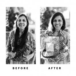 Baldihappy-BeforeAfter-Donors-13