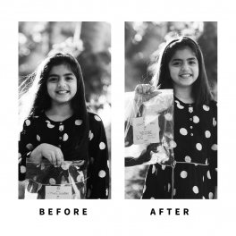 Baldihappy-BeforeAfter-Donors-14