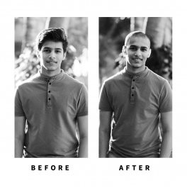 Baldihappy-BeforeAfter-Donors-17