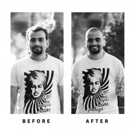 Baldihappy-BeforeAfter-Donors-18