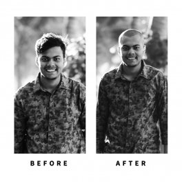 Baldihappy-BeforeAfter-Donors-19