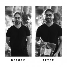Baldihappy-BeforeAfter-Donors-20