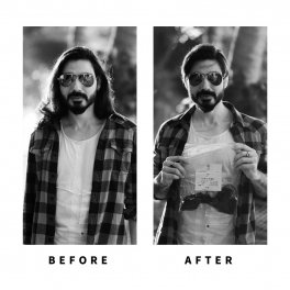 Baldihappy-BeforeAfter-Donors-21