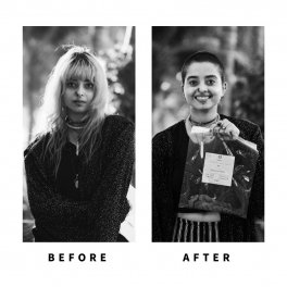 Baldihappy-BeforeAfter-Donors-22