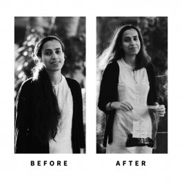 Baldihappy-BeforeAfter-Donors-23