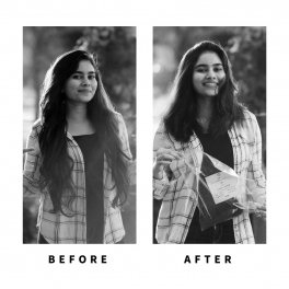 Baldihappy-BeforeAfter-Donors-24