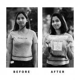 Baldihappy-BeforeAfter-Donors-25