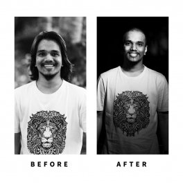 Baldihappy-BeforeAfter-Donors-26
