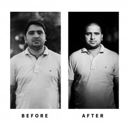 Baldihappy-BeforeAfter-Donors-27