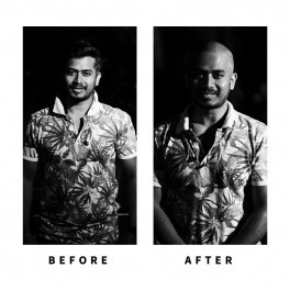 Baldihappy-BeforeAfter-Donors-28